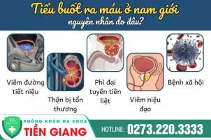 dau-la-nguyen-nhan-gay-ra-tinh-trang-tieu-buot-ra-mau-o-nam-gioi-cach-dieu-tri-hieu-qua-1215