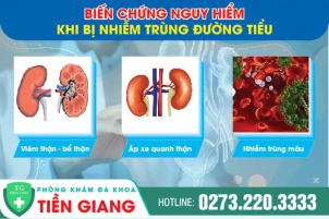 dia-chi-dieu-tri-nhiem-trung-tieu-hieu-qua-o-tien-giang-1364