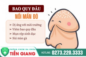 noi-man-do-bao-quy-dau-nguyen-nhan-va-cach-chua-tri-nhanh-chong-727