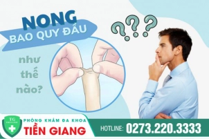 nong-bao-quy-dau-la-gi-chi-phi-va-phuong-phap-nong-hien-nay-601