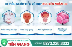 nuoc-tieu-co-bot-la-benh-gi-nguyen-nhan-va-cach-dieu-tri-1252