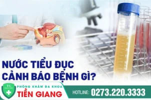 tai-sao-di-tieu-nuoc-tieu-duc-va-cach-dieu-tri-tieu-ra-nuoc-vang-duc-1462