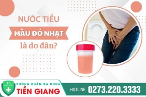 nuoc-tieu-co-mau-do-nhat-la-benh-gi-cach-dieu-tri-ra-sao-1281