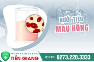 di-tieu-ra-mau-hong-la-bi-lam-sao-co-khoi-duoc-khong-1282