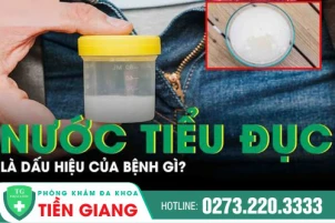 nuoc-tieu-mau-trang-la-bi-benh-gi-dieu-tri-nhu-the-nao-1457