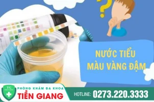 tai-sao-di-tieu-nuoc-tieu-mau-vang-dam-va-cach-dieu-tri-1463