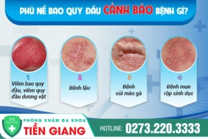 phu-ne-bao-quy-dau-dau-hieu-canh-bao-benh-gi-cach-dieu-tri-hieu-qua-hien-nay-899