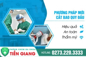 phuong-phap-cat-bao-quy-dau-khong-dau-chi-phi-thap-hien-nay-848