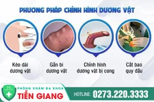 chinh-hinh-duong-vat-tham-my-tai-phong-kham-tien-giang-819