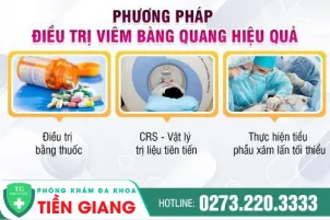 phuong-phap-chua-viem-bang-quang-hieu-qua-hien-nay-779