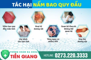 tong-quan-ve-nam-bao-quy-dau-va-cach-chua-tri-hieu-qua-tai-tien-giang-1345