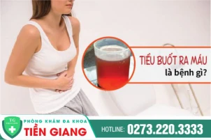 tieu-buot-ra-mau-o-nam-nguyen-nhan-va-cach-dieu-tri-hieu-qua-1396