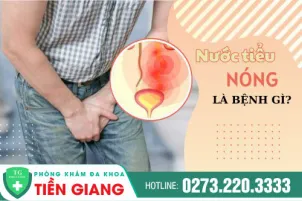di-tieu-nuoc-tieu-nong-la-dau-hieu-benh-gi-cach-dieu-tri-ra-sao-1249
