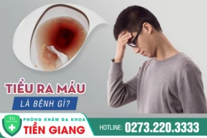 di-ve-sinh-ra-mau-o-nam-nguyen-nhan-va-cach-dieu-tri-hieu-qua-1464