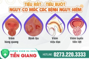 tieu-buot-tieu-rat-la-benh-gi-tac-hai-va-cach-dieu-tri-tieu-buot-hieu-qua-o-nam-gioi-1218