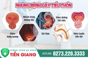 nam-gioi-di-tieu-bi-thon-nen-den-co-so-uy-tin-kham-ngay-587