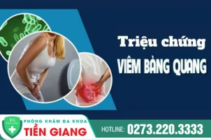 trieu-chung-viem-bang-quang-la-gi-cach-tri-viem-bang-quang-hieu-qua-1437