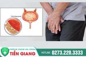 nguyen-nhan-viem-bang-quang-phuong-phap-tri-viem-bang-quang-hieu-qua-1431