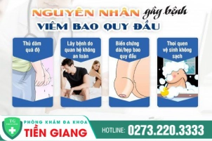 tri-viem-quy-dau-nhu-the-nao-chi-phi-dieu-tri-viem-bao-quy-dau-bao-nhieu-892