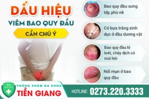 chi-phi-cat-bao-quy-dau-bao-nhieu-tien-1391