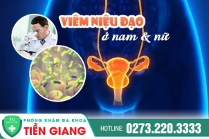 viem-nieu-dao-o-nam-va-nu-nhung-dieu-khong-nen-bo-qua-737