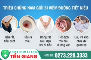 viem-tiet-nieu-nguyen-nhan-do-dau-cach-tri-viem-tiet-nieu-hieu-qua-1453