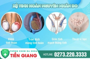 tinh-trang-tinh-hoan-xe-dau-hieu-tac-hai-phuong-thuc-chua-tri-604