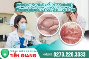 benh-lau-co-chua-khoi-duoc-khong-chua-bang-cach-nao-508