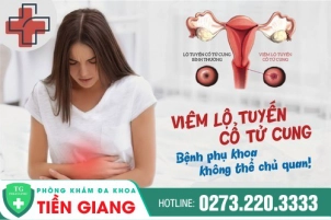 dieu-tri-viem-lo-tuyen-tu-cung-294