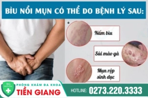biu-noi-mun-tim-hieu-nguyen-nhan-gay-ra-495