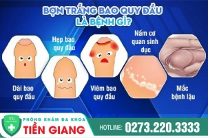 bon-trang-bao-quy-dau-la-gi-co-gay-nguy-hiem-cho-nam-gioi-334