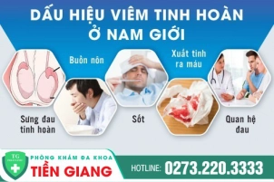 benh-viem-tinh-hoan-o-nam-gioi-va-nhung-phuong-phap-dieu-tri-toi-tan-hien-nay-14