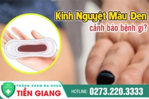 ly-do-khien-kinh-nguyet-ra-mau-nau-den-cach-dieu-tri-nhu-the-nao-135