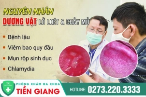 loet-duong-vat-o-nam-gioi-nguyen-nhan-va-phuong-phap-chua-tri-58