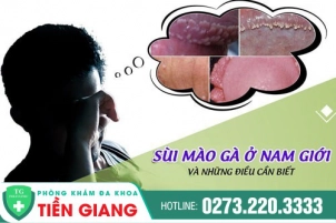 cach-dieu-tri-benh-sui-mao-ga-o-nam-nhanh-khoi-426