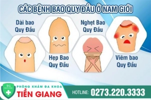 cac-benh-ve-bao-quy-dau-dang-pho-bien-hien-nay-can-biet-15