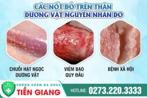 cac-not-do-tren-than-duong-vat-la-gi-nguyen-nhan-gay-ra-553
