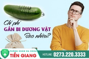chi-phi-gan-bi-duong-vat-bao-nhieu-447