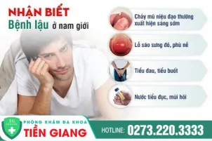 dau-hieu-benh-lau-o-nam-nguyen-nhan-ngan-chan-chua-tri-356