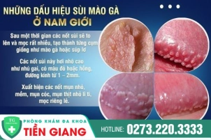 nhung-cach-nhan-biet-sui-mao-ga-o-nam-gioi-165