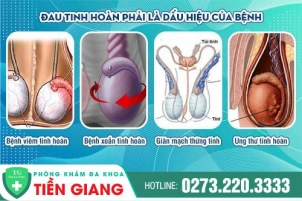 dau-tinh-hoan-phai-nguyen-nhan-do-dau-cach-khac-phuc-la-gi-324
