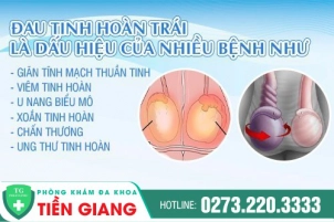 nam-gioi-dau-tinh-hoan-trai-la-benh-gi-nen-kham-o-dau-38