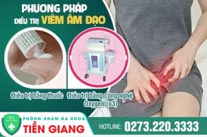 viem-am-dao-duoc-chan-doan-va-dieu-tri-nhu-the-nao-194