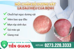 duong-vat-noi-cac-cham-do-cac-benh-pho-bien-thuong-gap-548