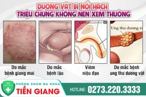 duong-vat-bi-noi-hach-lieu-co-phai-benh-xa-nguy-hiem-108