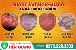 duong-vat-nam-gioi-bi-noi-man-do-bien-phap-khac-phuc-la-gi-570
