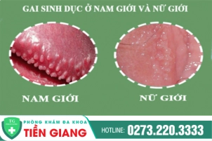 gai-sinh-duc-co-lam-anh-huong-den-suc-khoe-hay-khong-390