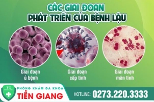 tung-giai-doan-phat-trien-cua-benh-lau-359