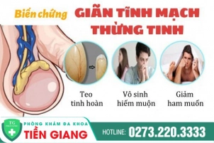 gian-tinh-mach-thung-tinh-la-gi-co-gay-nguy-hiem-cho-nam-gioi-401