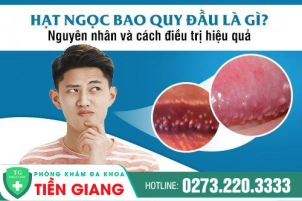 hat-ngoc-o-bao-quy-dau-nam-gioi-do-dau-gay-nen-562